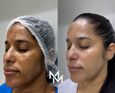 Maísa Melo - Saúde e Estética - Foto 2