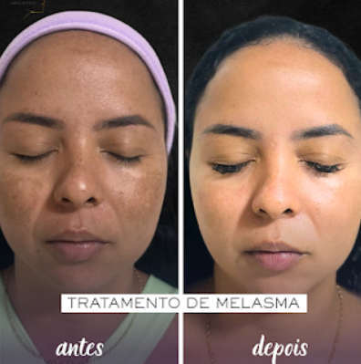 Maísa Melo - Saúde e Estética - Foto 3