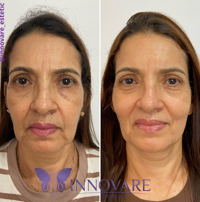 Innovare Estética - Foto 1