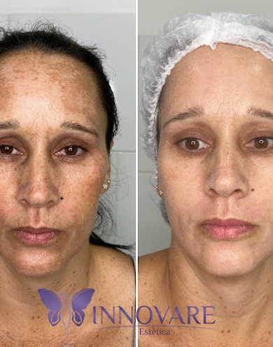 Innovare Estética - Foto 3