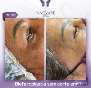 Innovare Estética - Foto 4