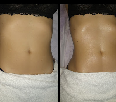 Espaço Cuidar - Consultório Fisioterapêutico e Estética - Foto 2