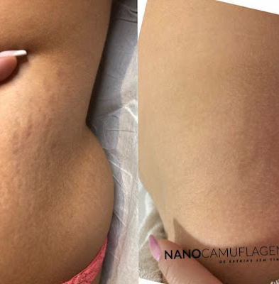 Studio Greici Estética e Mega Hair - Foto 1