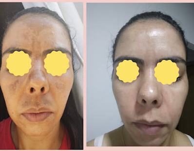 Studio Greici Estética e Mega Hair - Foto 2